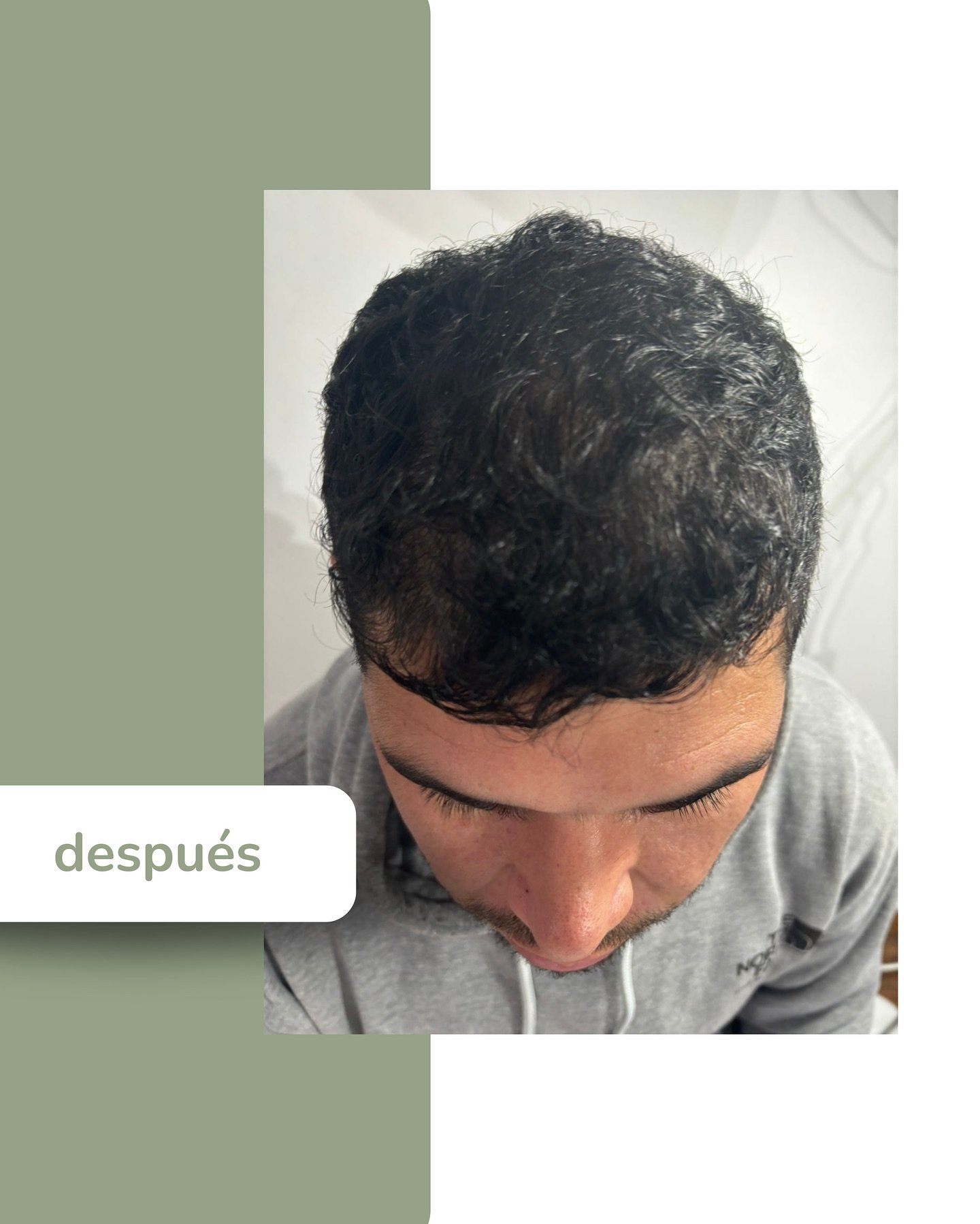 Después