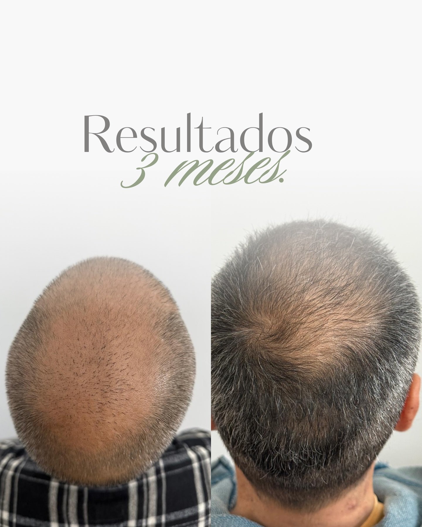 Antes